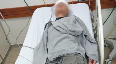 Patota atacó a botellazos a un adolescente para robarle la gorra