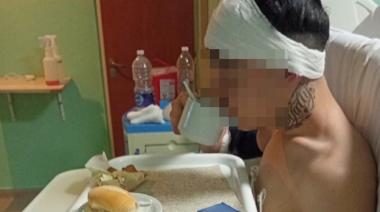 Le dieron el alta al adolescente atacado a botellazos por una patota: buscan identificar a los agresores