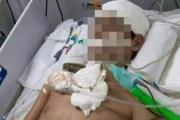 Atacaron a un martillazos a un adolescente en Lomas y está muy grave