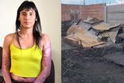 A un año del ataque, Lorena Leiva aún necesita ayuda para su tratamiento