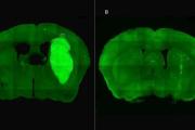 Un avance del CONICET para la lucha contra el cáncer cerebral