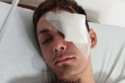 Brutal golpiza a la salida de un boliche: lo tuvieron que operar dos veces, pero no sabe quién le pegó