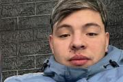 Le dispararon seis veces por un celular y ahora lucha para recuperar la pierna