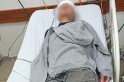 Patota atacó a botellazos a un adolescente para robarle la gorra